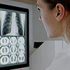 Ärztin spricht per Videokonferenz mit Patientin; auf dem Computermonitor sind verschiedene Röntgenaufnahmen zu sehen.
