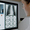 Ärztin spricht per Videokonferenz mit Patientin; auf dem Computermonitor sind verschiedene Röntgenaufnahmen zu sehen.